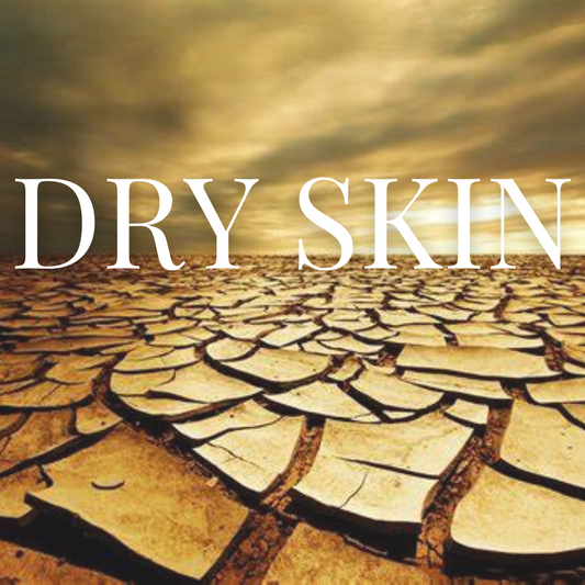 What's Your Type: Dry Skin